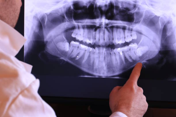 Best Walk-In Emergency Dentist in Guntersville, AL